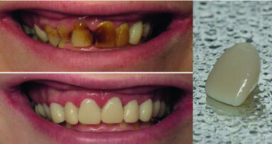 Provisoires et Progiciel, le duo d’experts