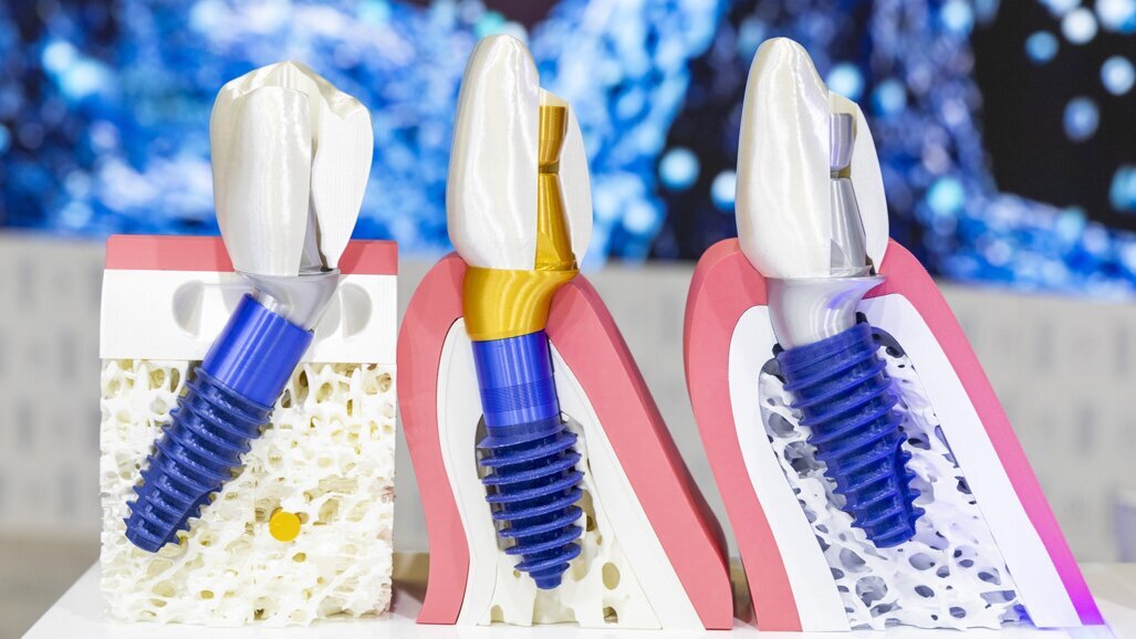 MegaGen introduces the fourth innovation in implantology