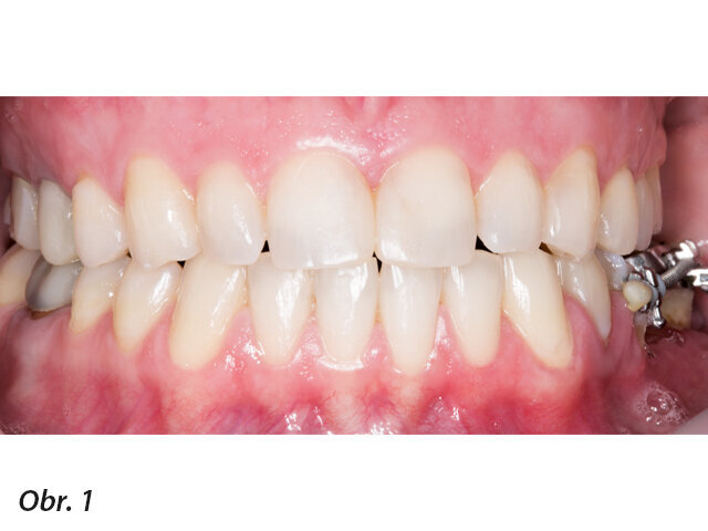 Počáteční klinická situace