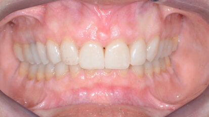 Un nuovo sorriso grazie alla Medicina Estetica Odontoiatrica