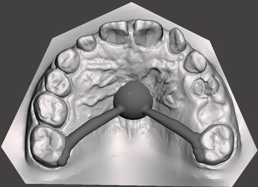 Fig. 25_Progetto CAD della Nance in Trilor.