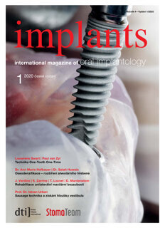 implants Czech Republic No. 1, 2020
