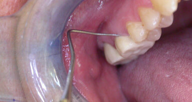Negare l’evidenza, non aiuta a nascondere gli errori, favorisce solo il contenzioso