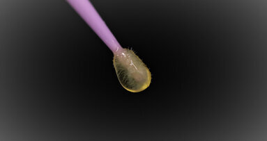 Interview: “A multi-step universal adhesive is a logic next evolution”