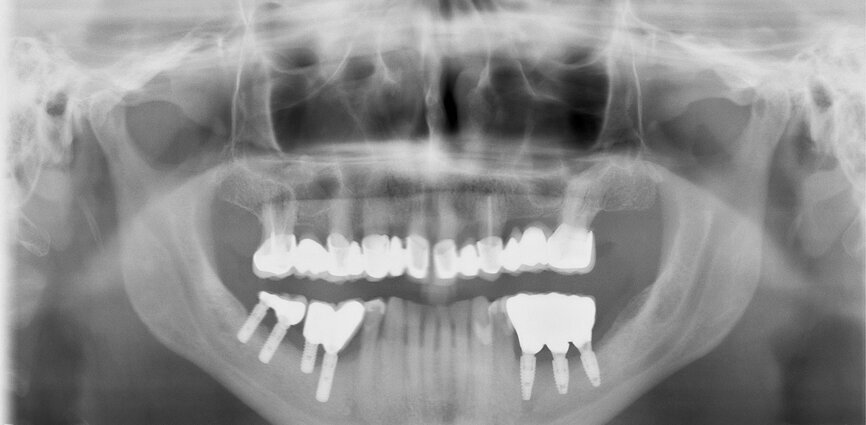 Fig. 7: Situation after treatment.
