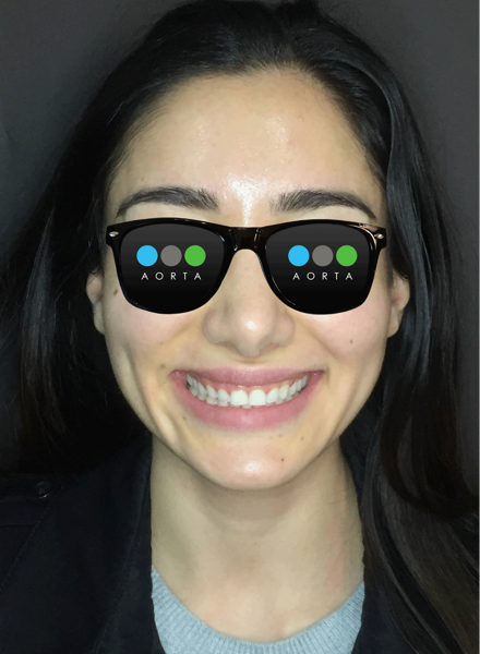 Fig. 5: Patient’s facial photograph after aligner treatment.