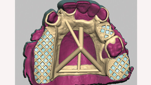 SensAble Technologies names Core 3D as worldwide authorized milling center