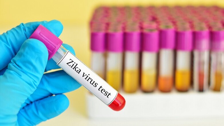 Researchers test new means of Zika diagnosis