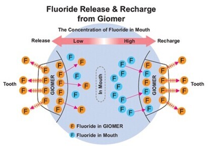 GIOMER materials: Essential ingredients for a healthy smile