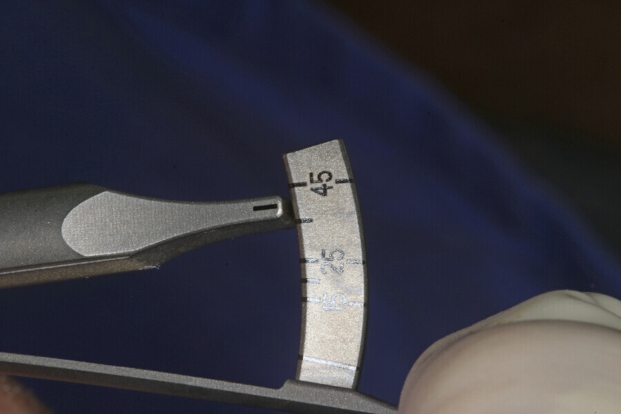 Fig. 4: Final torque of 45 Ncm.