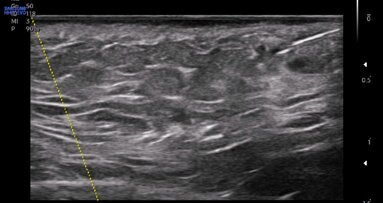 Qualità e sicurezza in medicina estetica del volto: il ruolo  dell’ecografia ambulatoriale