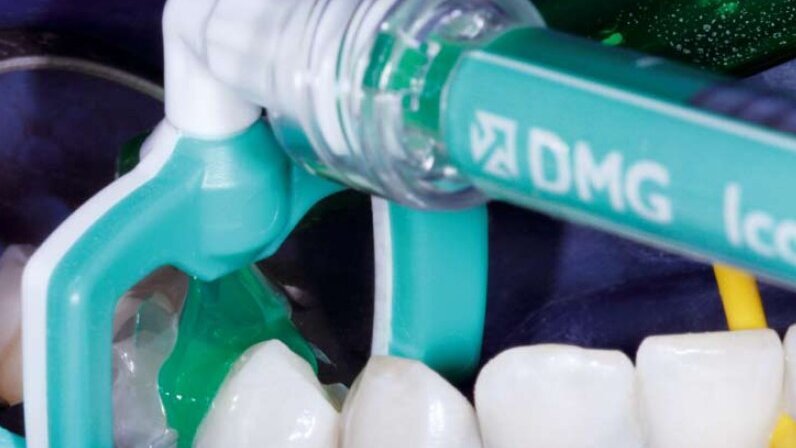 Τρόχισμα με ...τζελ