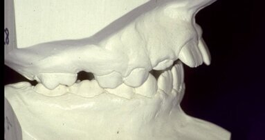 Die weitreichende Bedeutung der kieferorthopädischen Behandlung