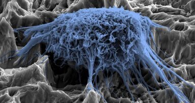 Pesquisadores desenvolvem novo revestimento para evitar infecções por implante dentário