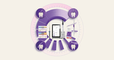 FKG Dentaire launches 4D Workflow for streamlined endodontics