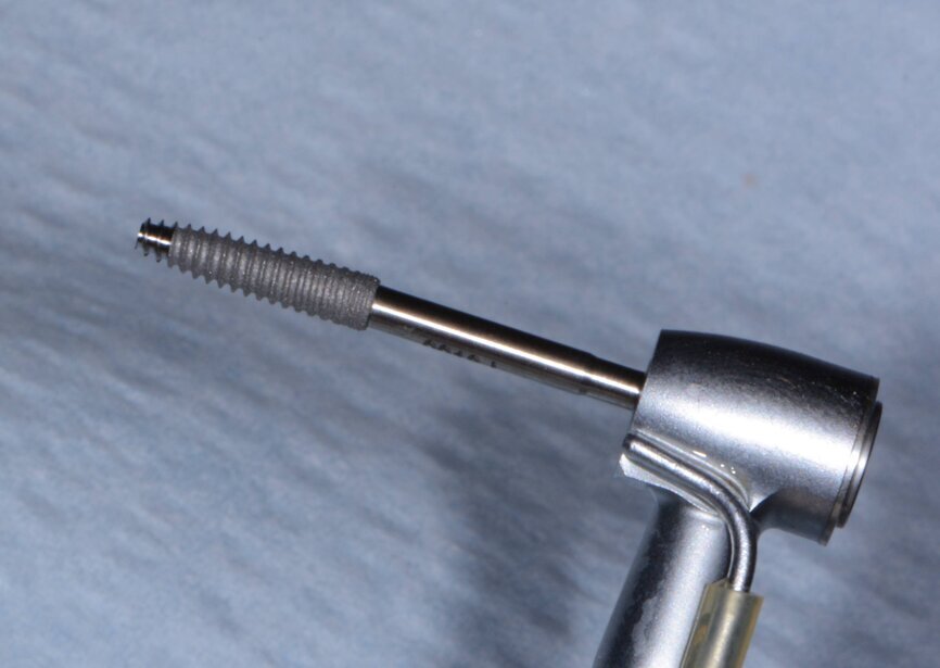 Fig. 12: Engage dental implant.