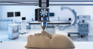 Individuelle Gesichtsimplantate mithilfe von KI