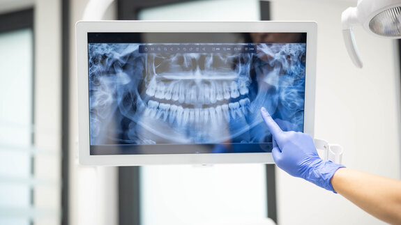 Jedes achte Röntgengerät mit Mängeln – das zeigt der TÜV-Report