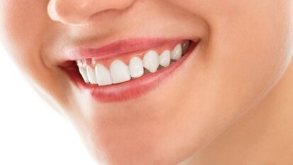 NVvO bezorgd over doe-het-zelfbeugel