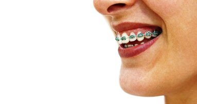 Kosmetyczna ortodoncja?