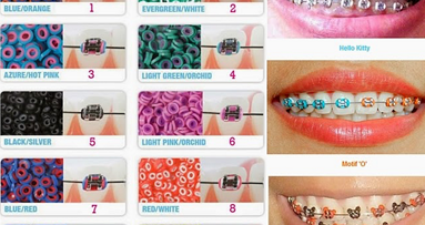 La irresistible moda de los brackets