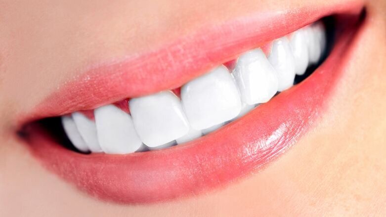 Tandbleekmiddelen mogelijk schadelijk voor tandbeenweefsel