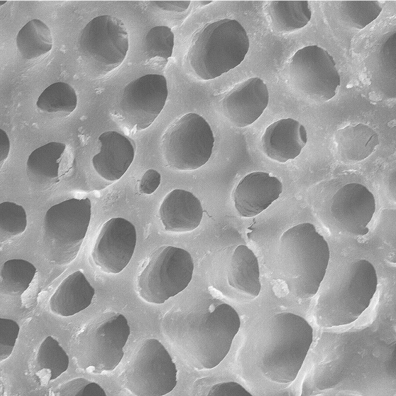 Fig. 1a: Izložena površina dentina.* (Slika: Curasept)