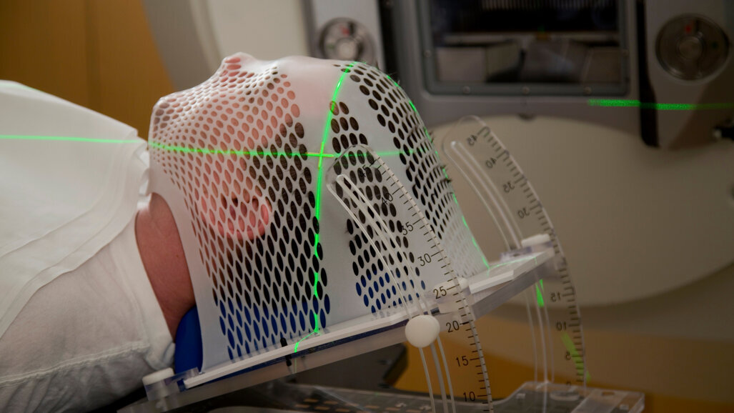 Sănătatea orală bună este asociată cu o supraviețuire îmbunătățită în rândul pacienților cu cancer de cap și gât