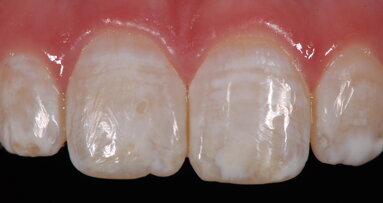 La importancia del pH en los agentes aclaradores