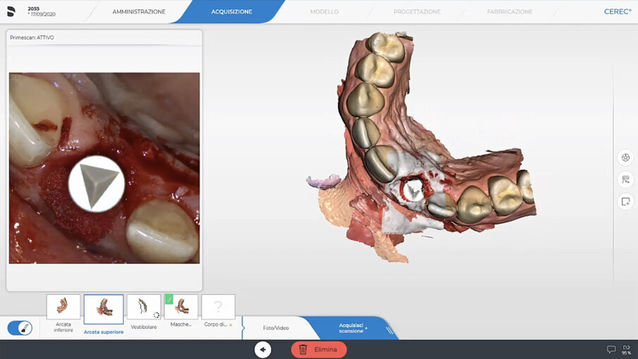 Fig. 23_Impronta digitale definitiva.
