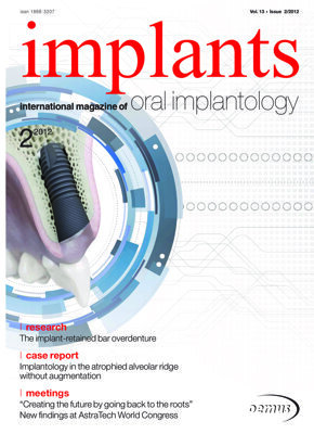 implants international No. 2, 2012 implants international No. 2, 2012