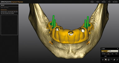 Nová řešení v programech Zirkonzahn: Perfektní v digitálním zpracování