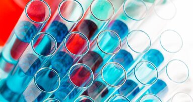 Badaczki UJ opracowały nowy sposób pozyskiwania komórek tkanki kostnej do bezpiecznych przeszczepów