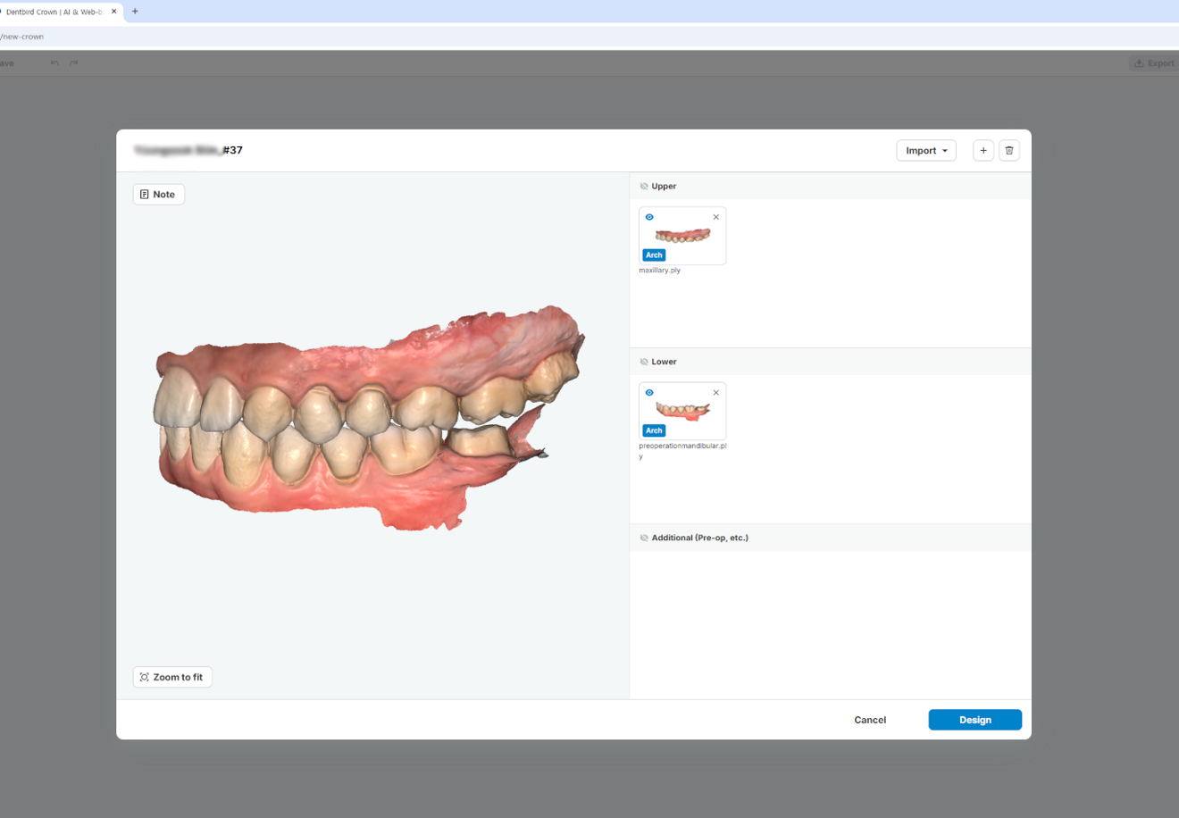 Fig. 1d: Confirmation of maxillary and mandibular datasets prior to AI design generation