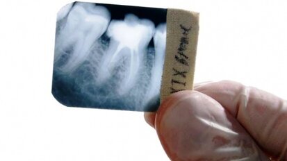 Carestream Health podwyższa ceny filmów do badań radiologicznych