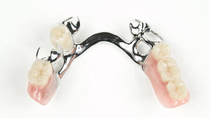 False teeth stuck in throat for nine weeks