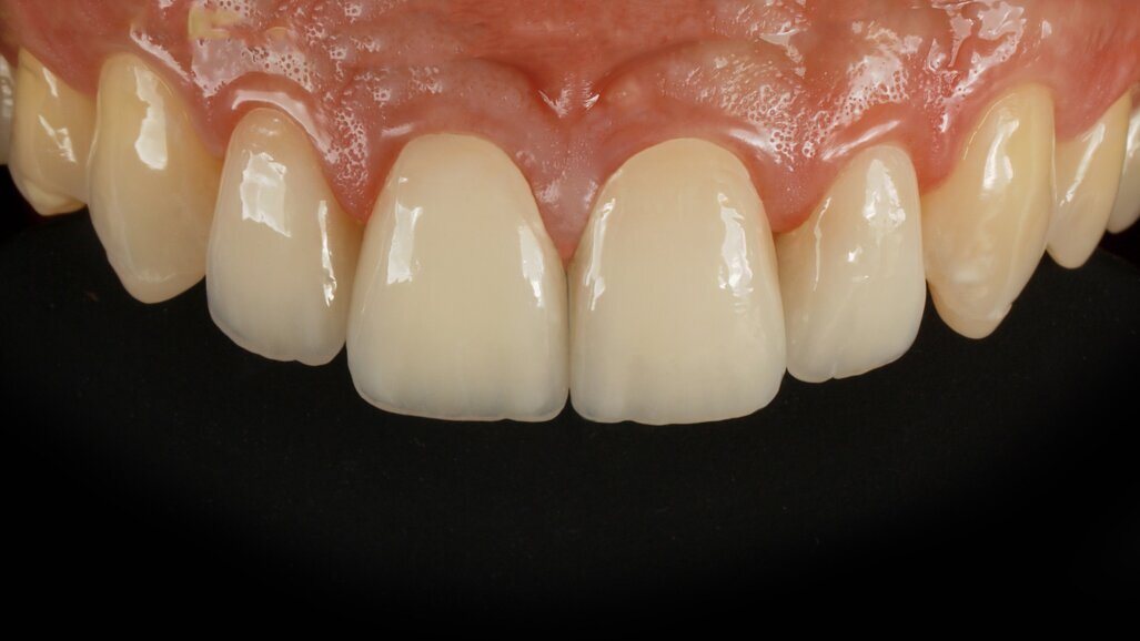 Hội thảo trên web miễn phí với chủ đề gốm thủy tinh kết tinh trước