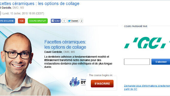 Webinaire « Facettes céramiques : les options de collage »