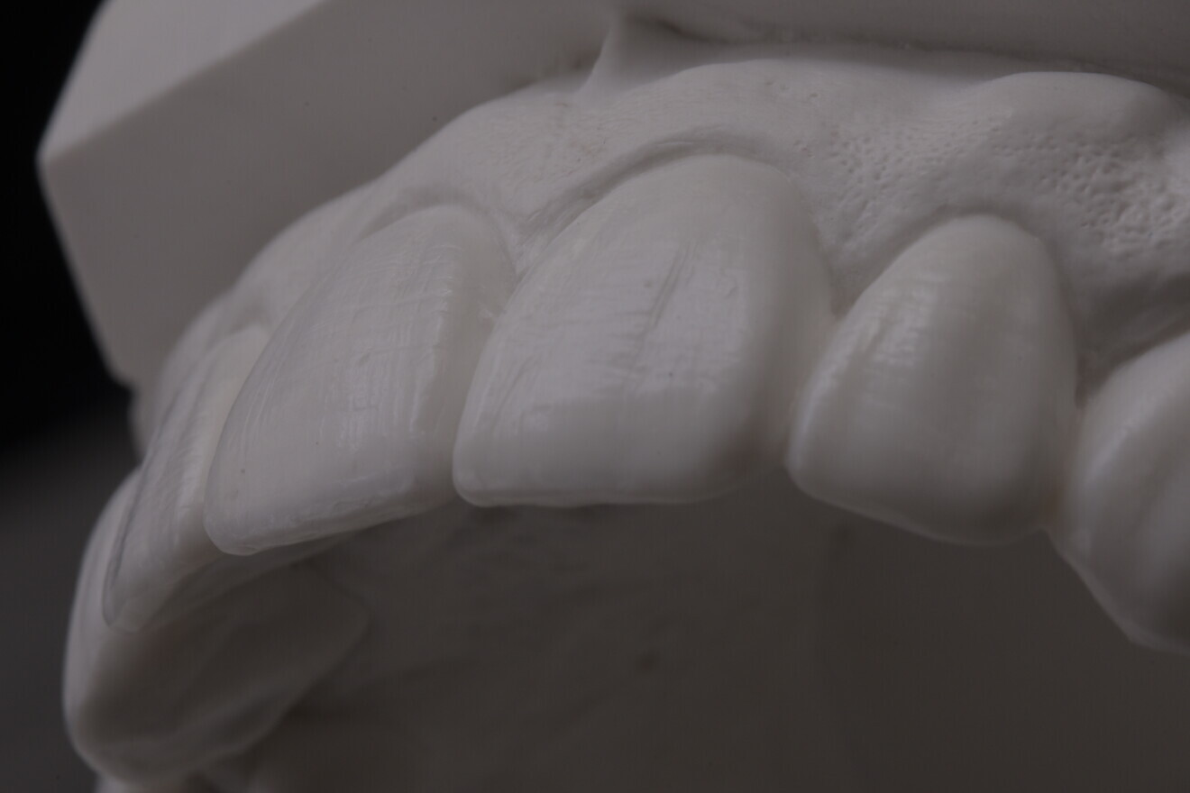 Fig. 3c: Diagnostic mock-up.