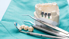 Association between clinical and  demographic variables and the success  of single-tooth dental implants: A cross-sectional study