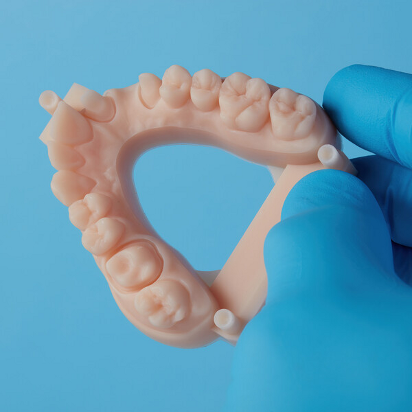 Fig. 6: Restorative model printed in Model Resin (V3, Formlabs) in 50 µm.