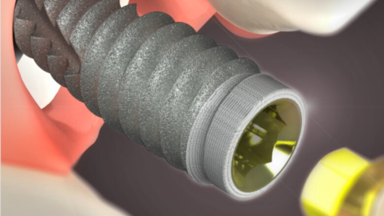 BioHorizons grants gift to NYU Dentistry to expand access, education for implant dentistry