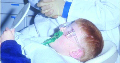 The Hall Technique: The novel method in restoring the carious primary molar