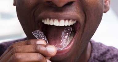 Why home treatment kits cannot replace a medical professional