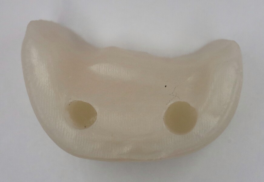 Fig. 16c: Milled zirconia pinlay: internal surface with the two pin spaces. 