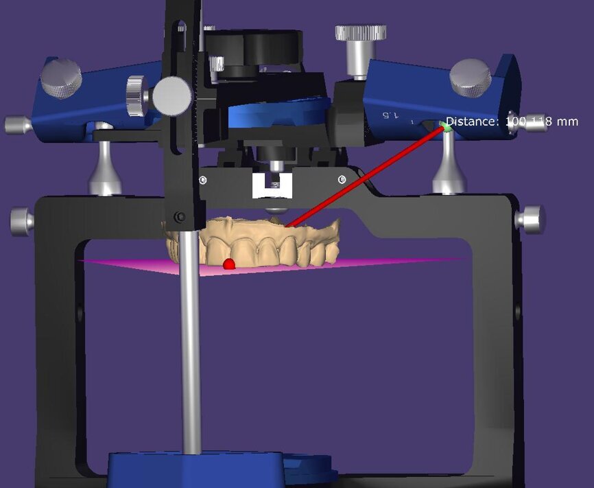 Fig. 11: Model orientation in the virtual articulator using the distance from the centre of rotation of the condyles to the central incisors as the distance for proper mounting.