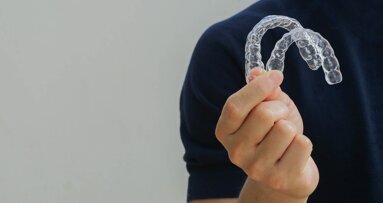 Treatment of ectopic canines with aligners and the MTA auxiliary