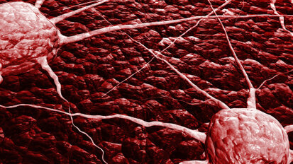 Forscher spüren wandernde Krebszellen auf Forscher spüren wandernde Krebszellen auf