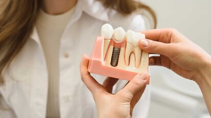 S3-Leitlinie Periimplantäre Weichgewebe-Augmentation