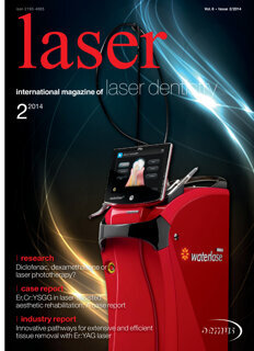 laser international No. 2, 2014 laser international No. 2, 2014